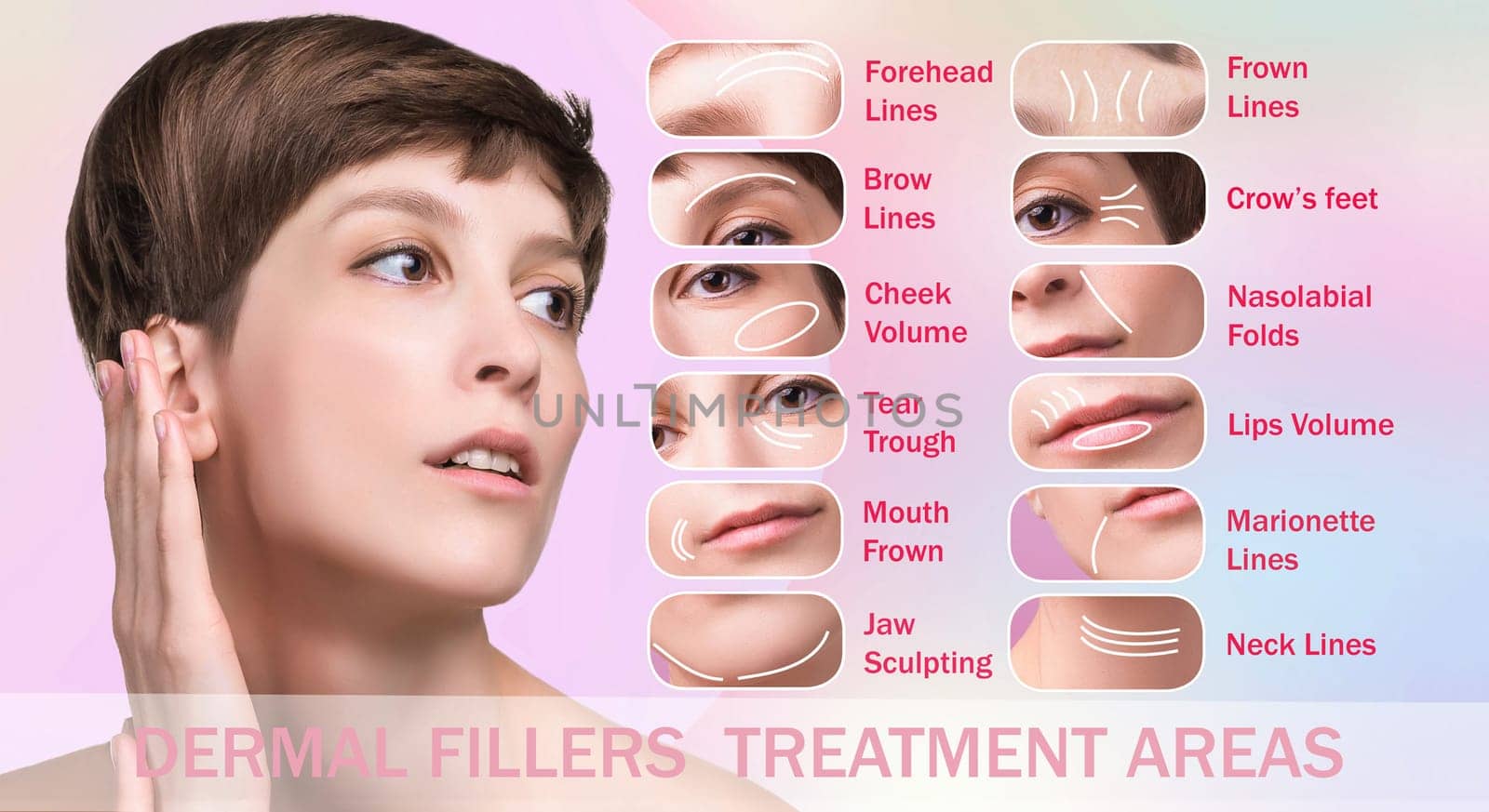 Treatment areas for anti-wrinkle injection. Young female with clean fresh skin. Beautiful woman. Female face and neck. Portrait of young caucasian woman . Lifting by thread concept