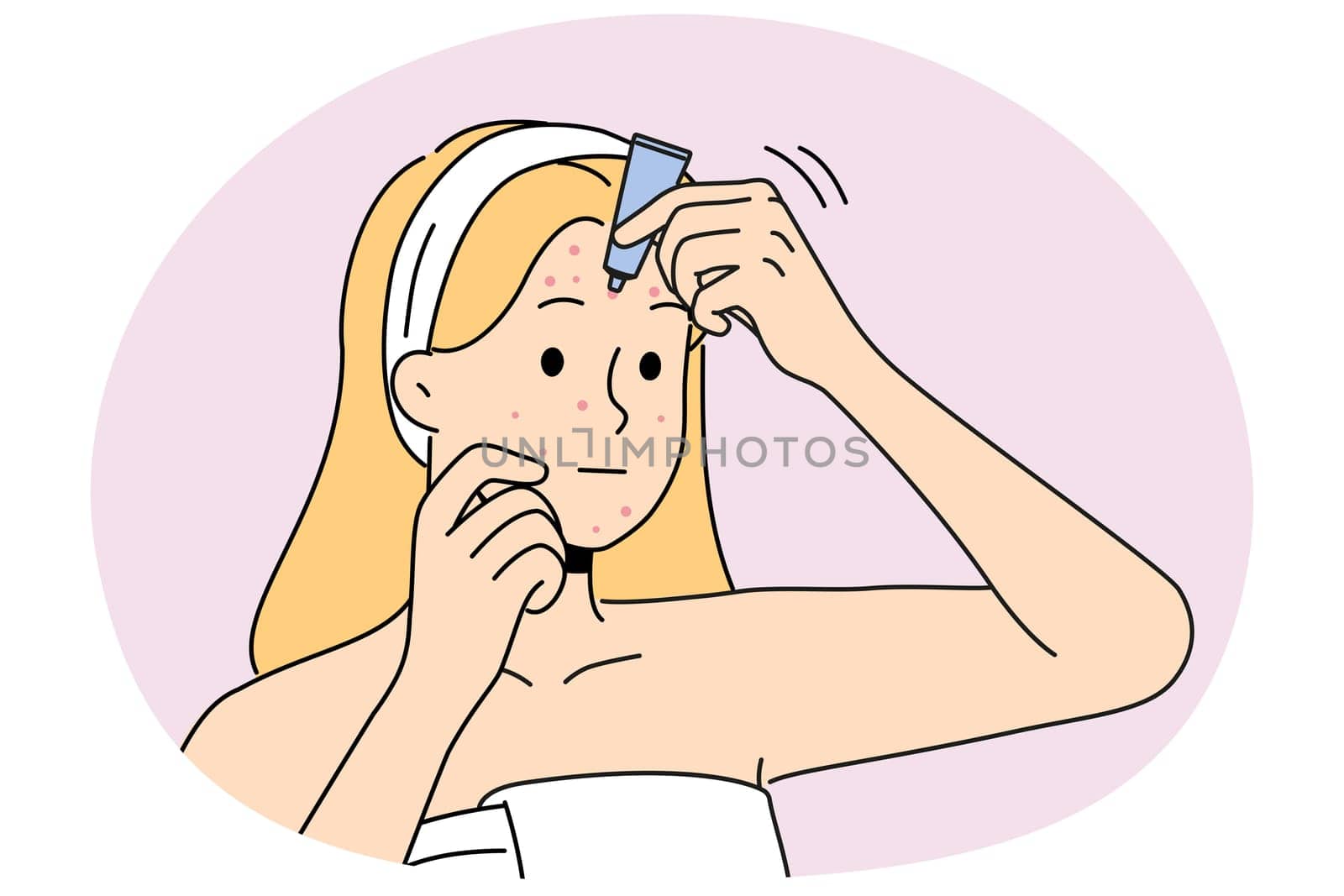 Woman in bathrobe apply cream on pimples on face. Unhappy girl treat redness struggle with facial problems. Skincare and beauty. Vector illustration.