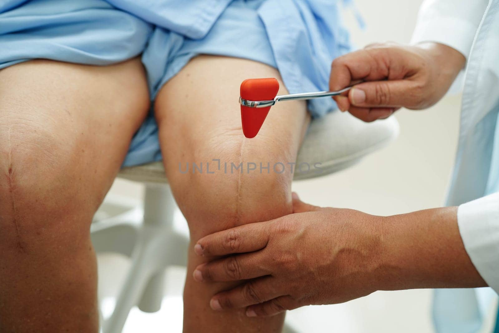 Asian doctor knock on knee reflex nerve for check and treatment senior patient in hospital.