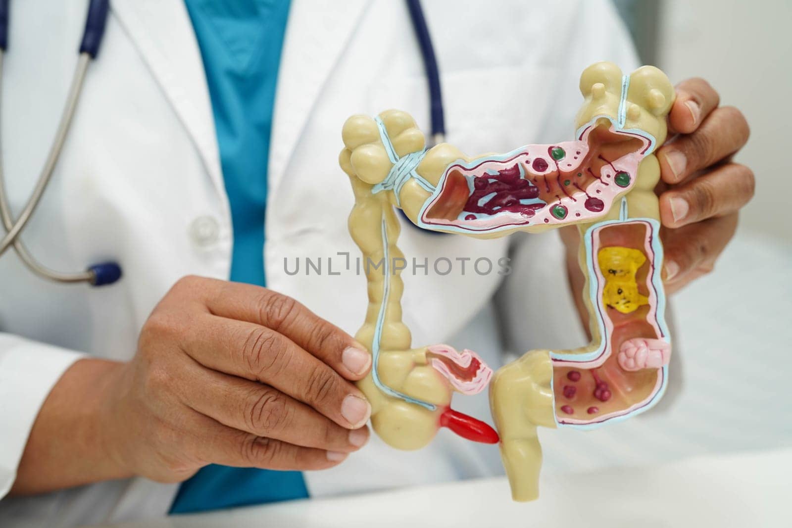 Intestine, doctor holding human anatomy model for study diagnosis and treatment in hospital.