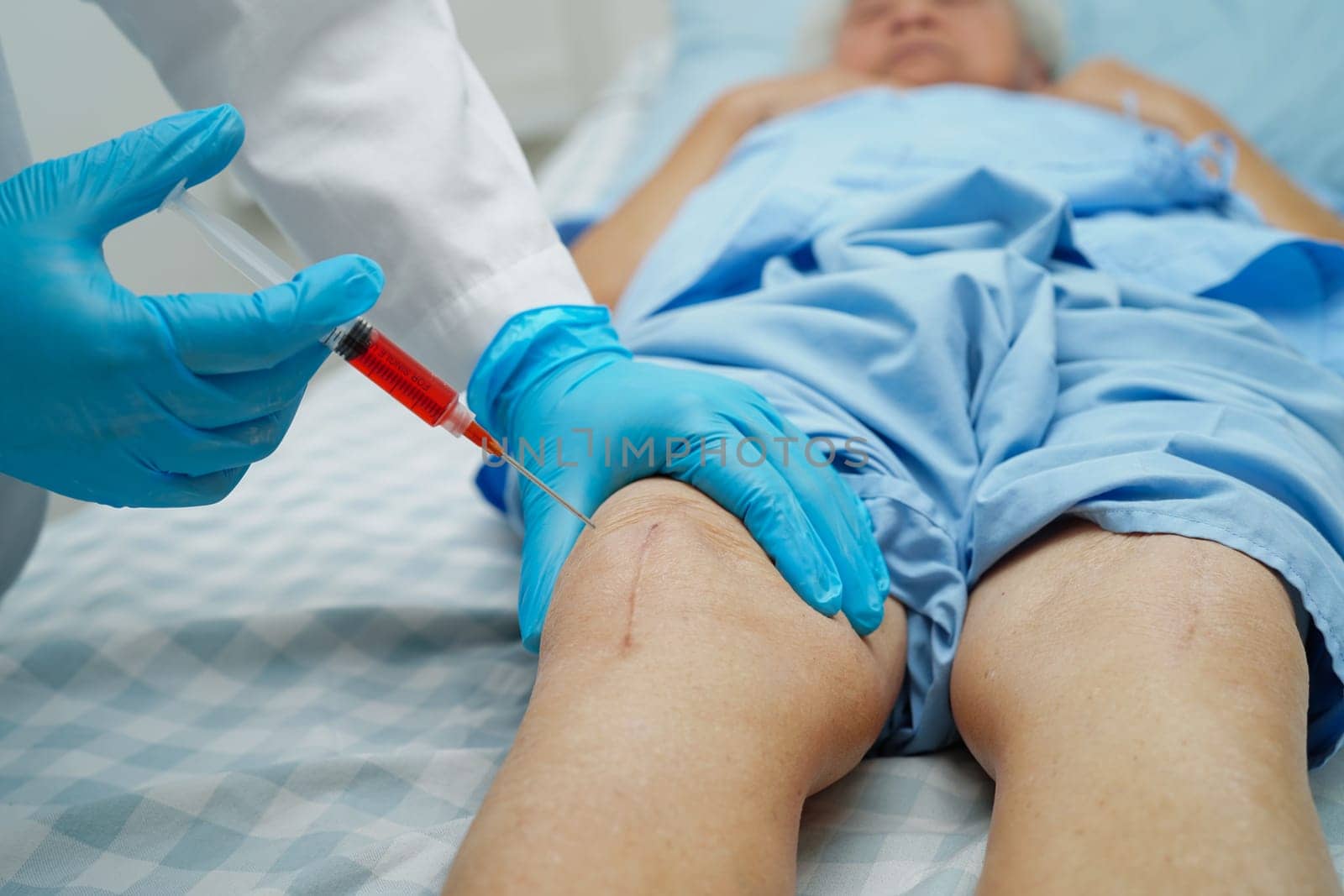 Asian doctor inject Hyaluronic acid platelet rich plasma into the knee of senior woman to walk without pain.