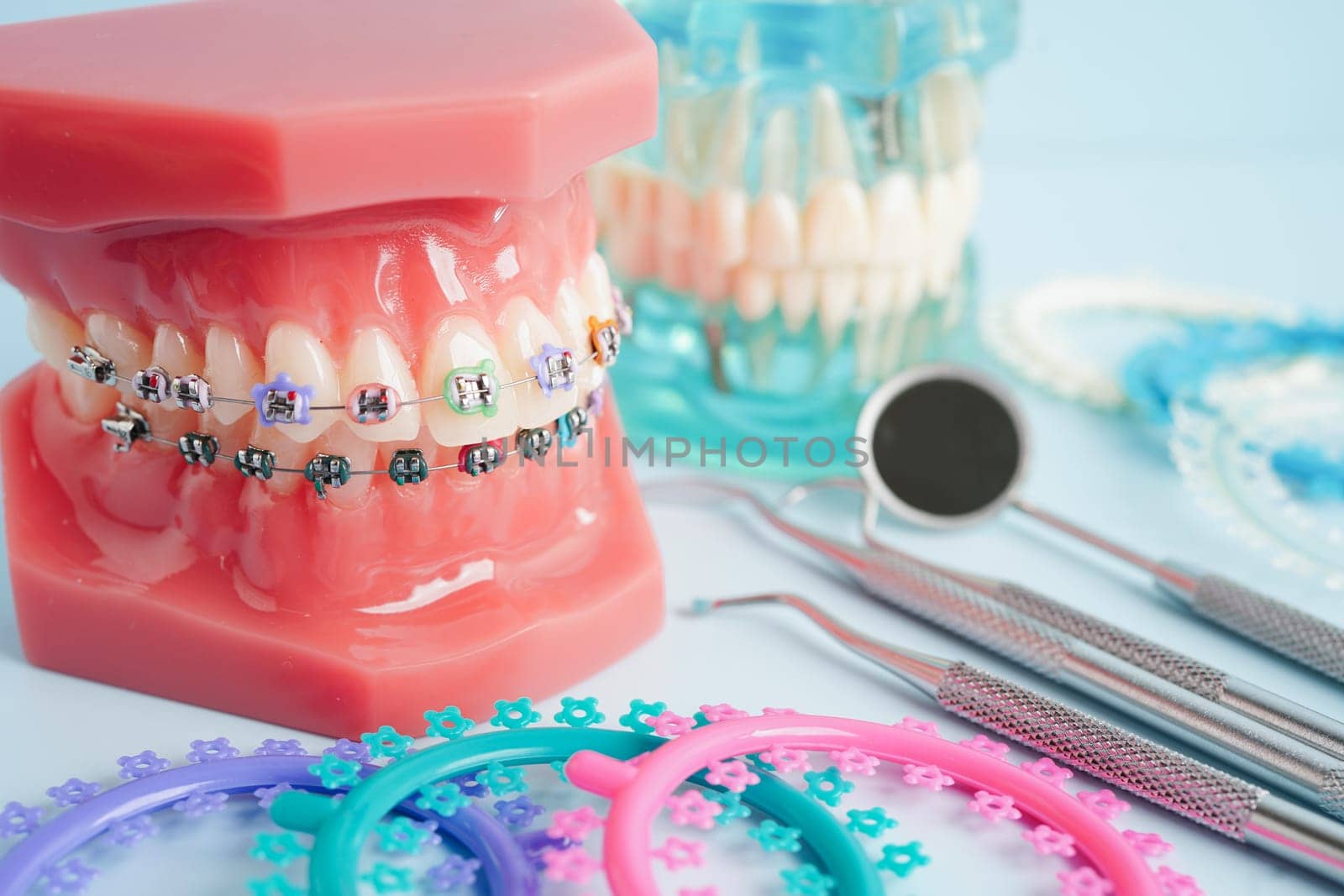 Orthodontic ligatures rings and ties, elastic rubber bands on orthodontic braces, model for dentist studying about dentistry.