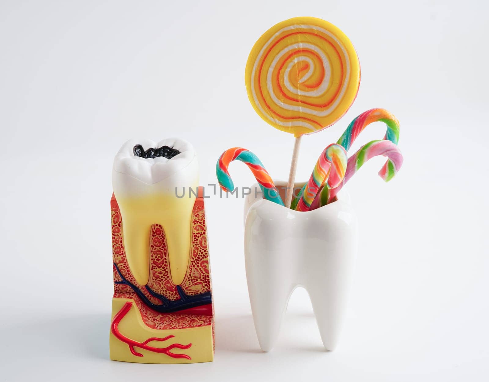 Tooth decay with sweet sugar candy, bad food for dental health care.