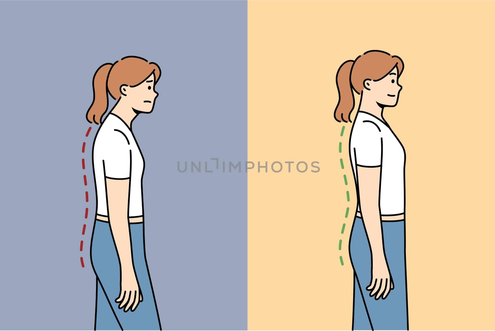 Scoliosis or osteochondrosis in woman, due to problems with posture and sore spine, which has recovered after doing fitness. Problem scoliosis in female office employee because of sedentary lifestyle