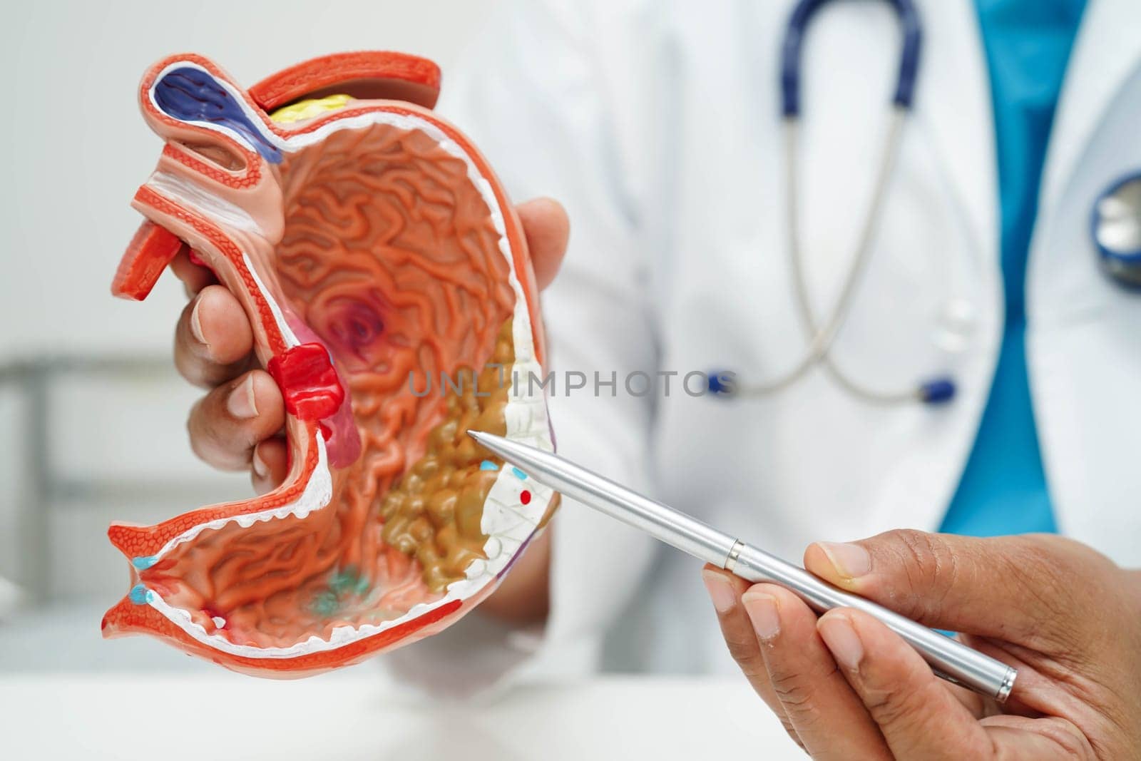 Stomach disease, doctor holding anatomy model for study diagnosis and treatment in hospital.