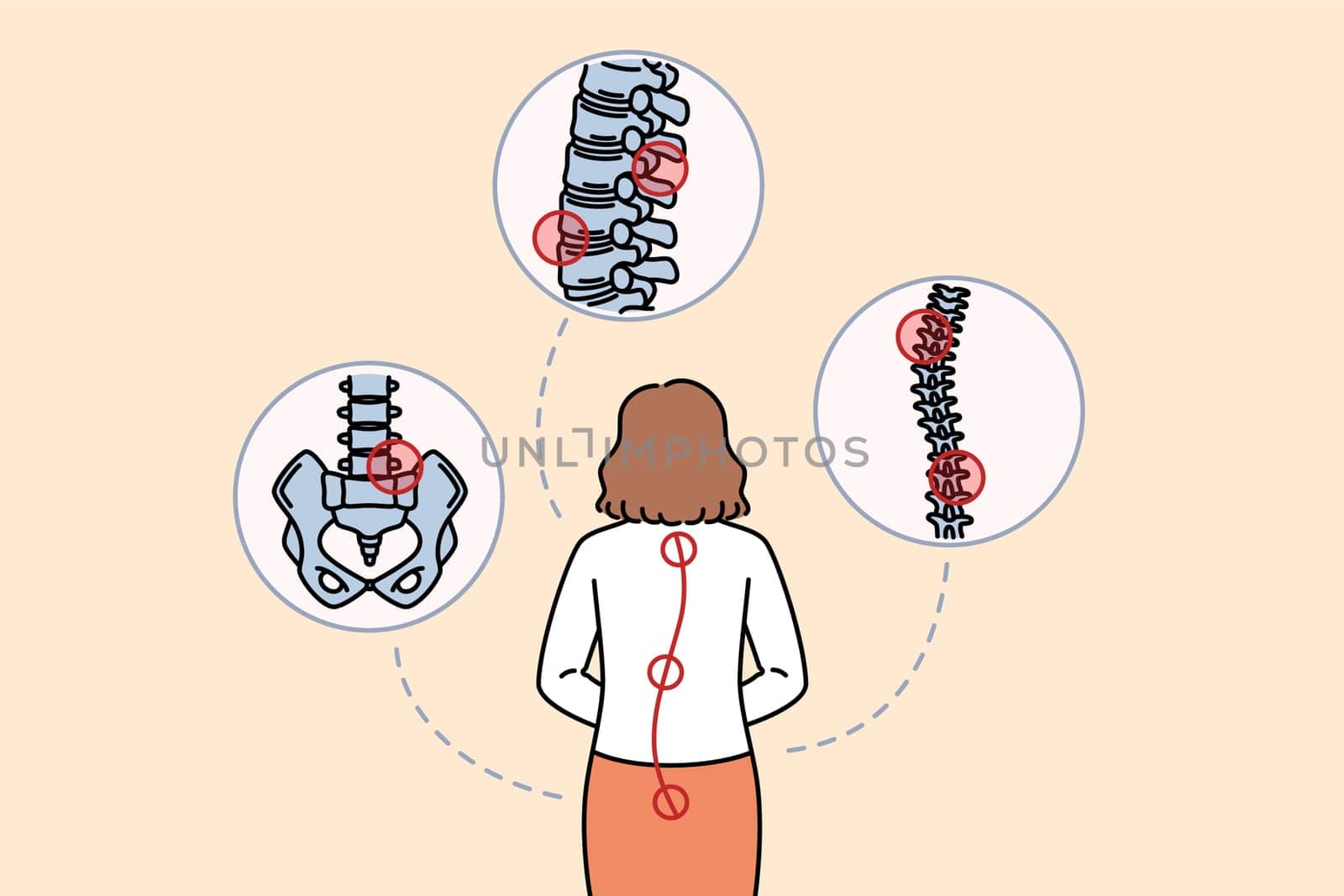 Woman with sore spine stands with back to camera and needs help of massage therapist or osteopath. Businesswoman sore spine appeared as result of sedentary lifestyle and bad office chair.