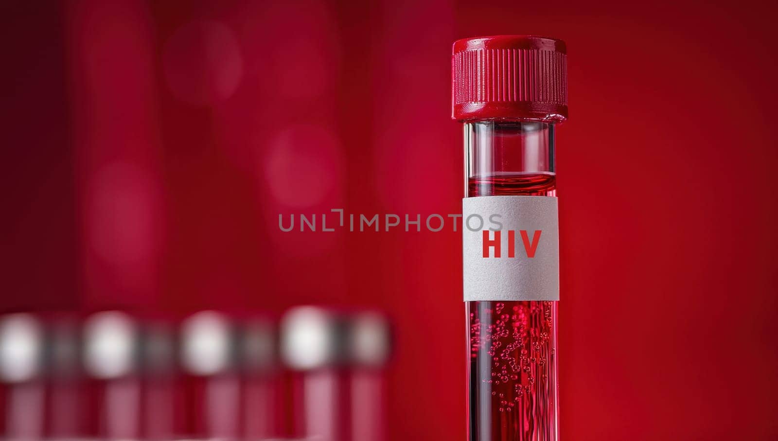 Blood sample for HIV virus analysis. Concept of AIDS, healthcare, and medical research.