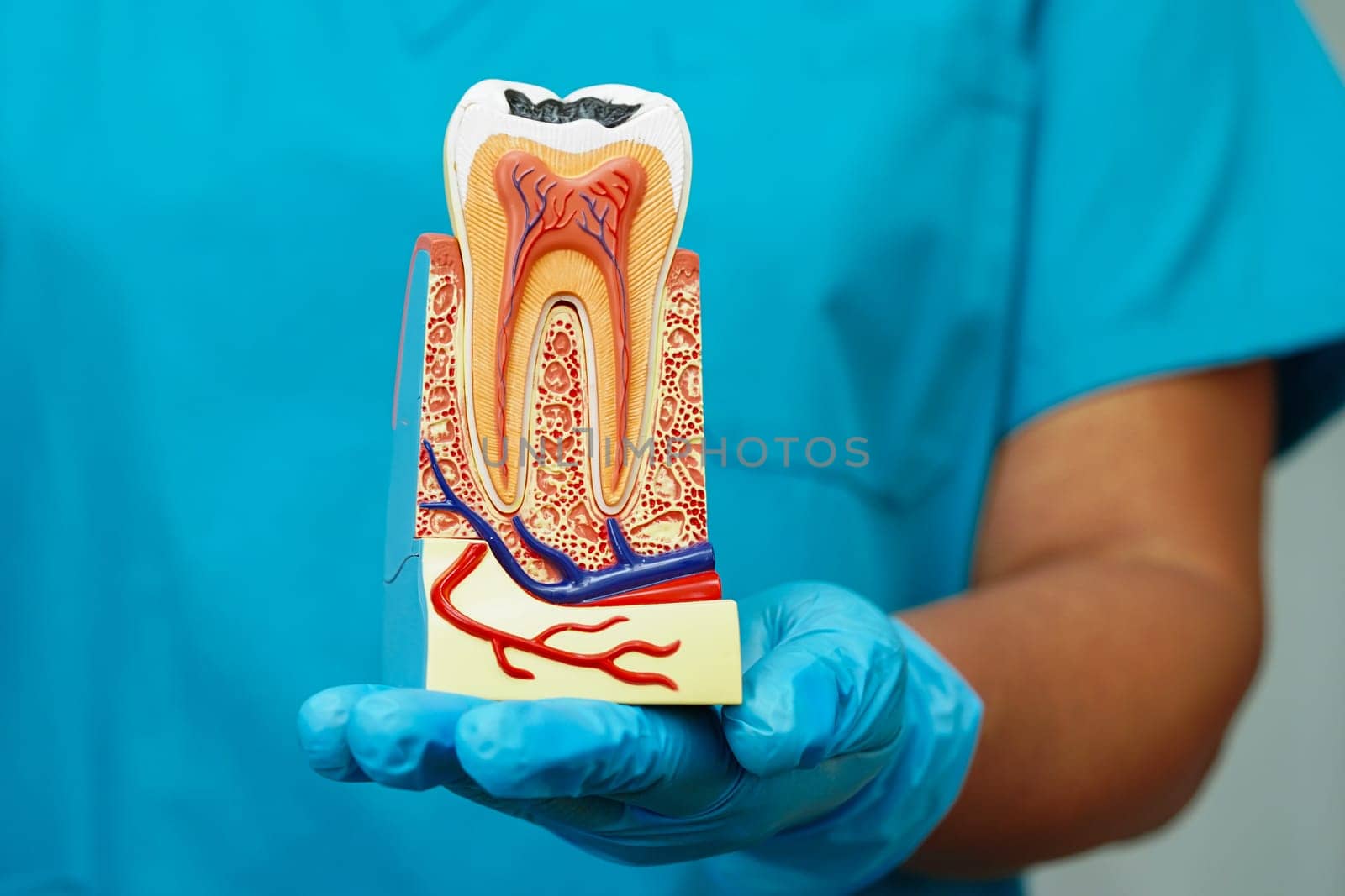 Dentist holding dental implant, artificial tooth roots into jaw, root canal of dental treatment, gum disease, teeth model for dentist.