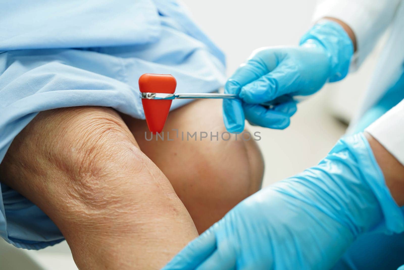 Asian doctor knock on knee reflex nerve for check and treatment senior patient in hospital.