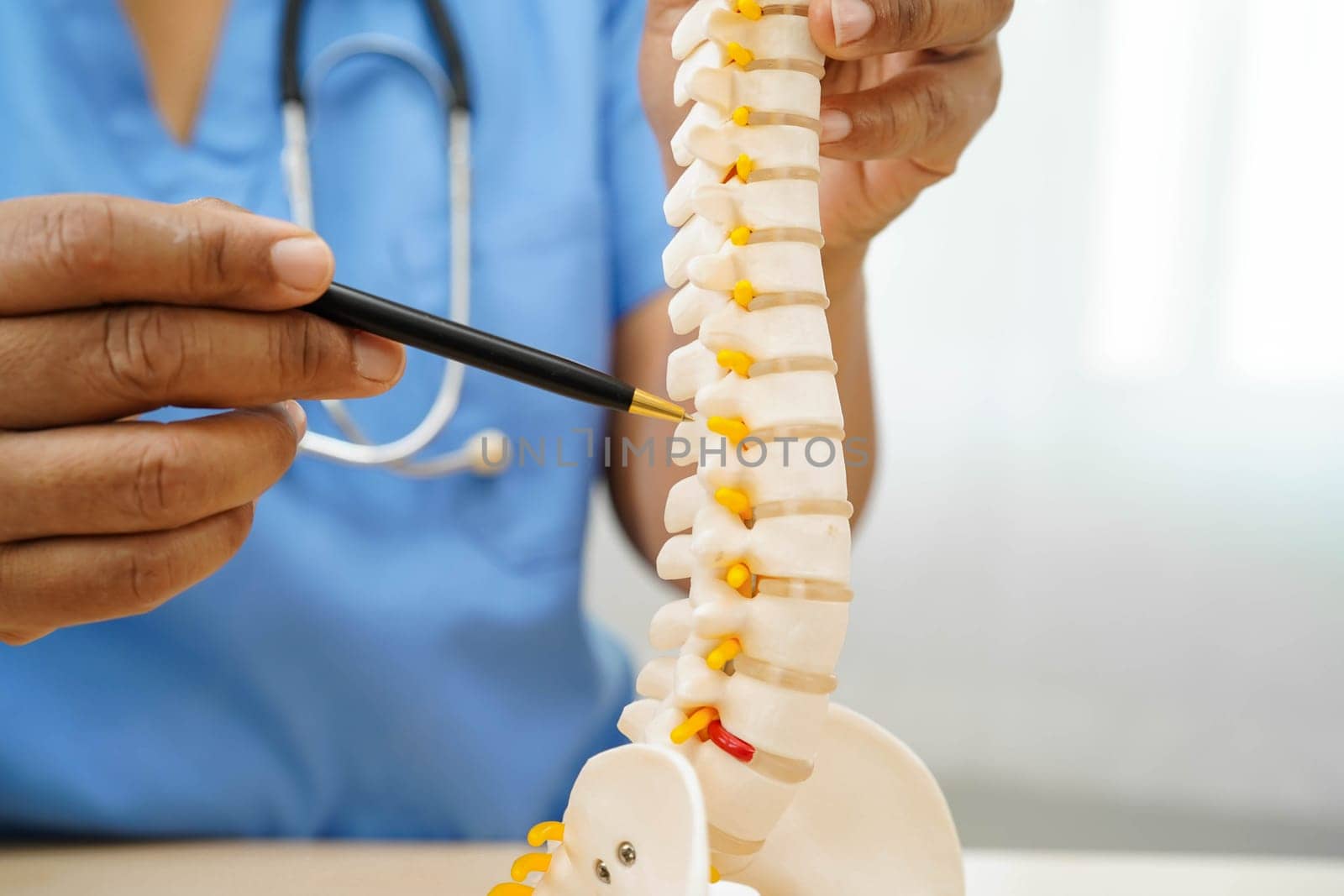 Asian doctor holding spinal nerve and bone model, Lumbar spine displaced herniated disc fragment for treatment medical in the orthopedic department.