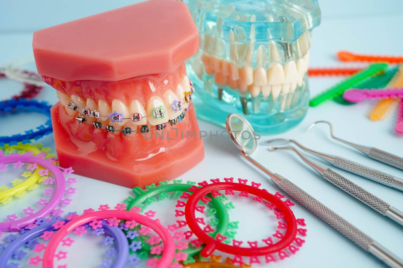Orthodontic ligatures rings and ties, elastic rubber bands on orthodontic braces, model for dentist studying about dentistry.