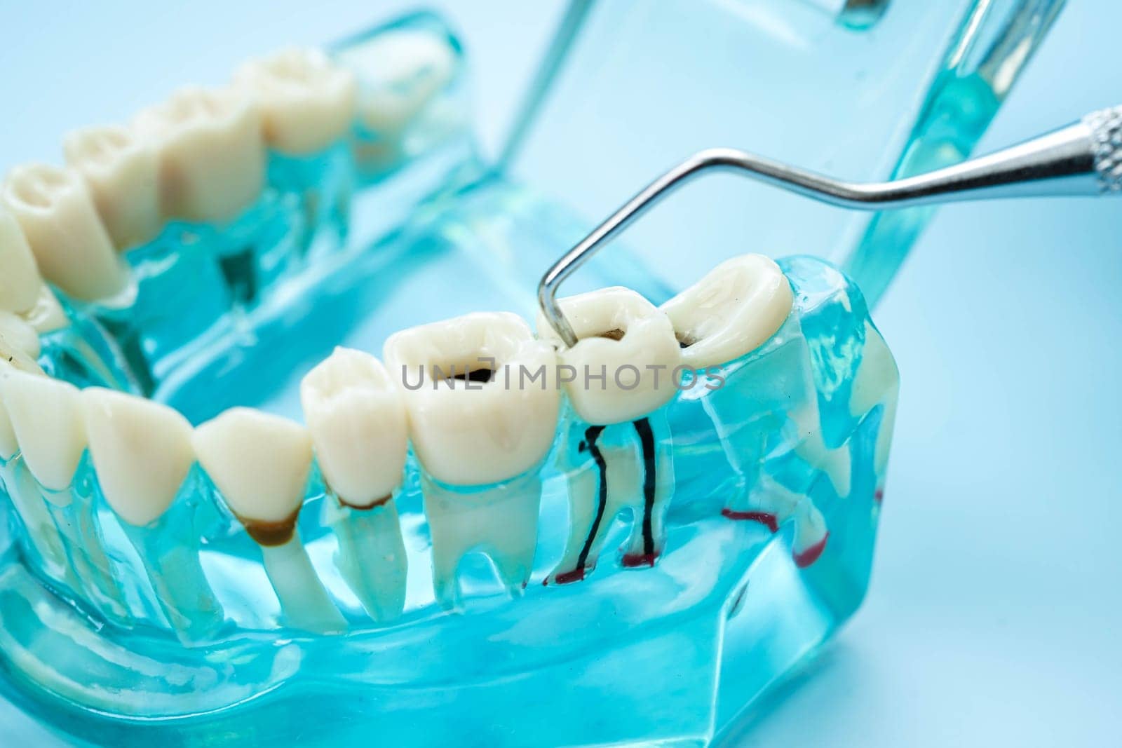 Teeth dental model with tool for dentist use to cleaning care treatment.