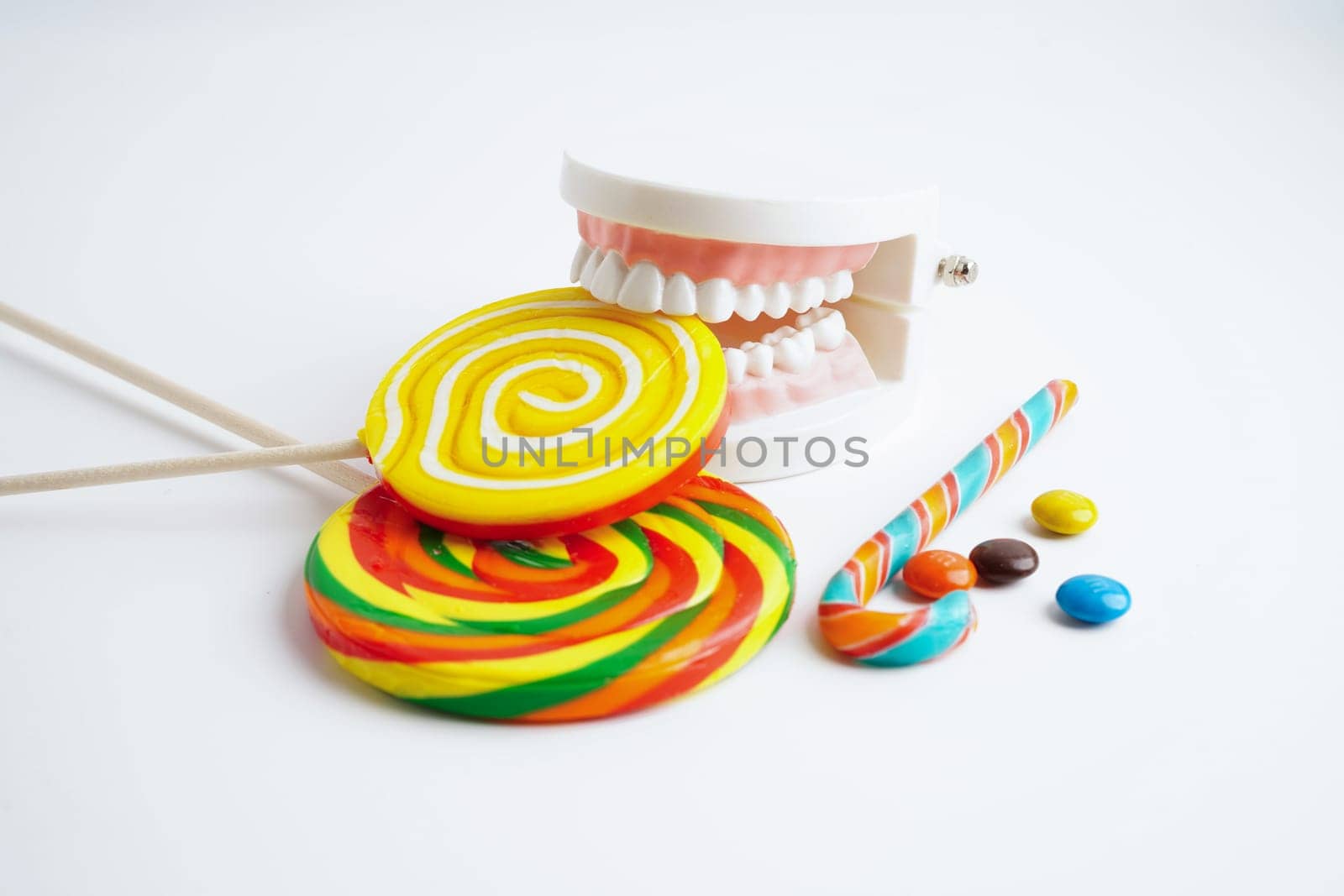 Tooth decay with sweet sugar candy, bad food for dental health care.