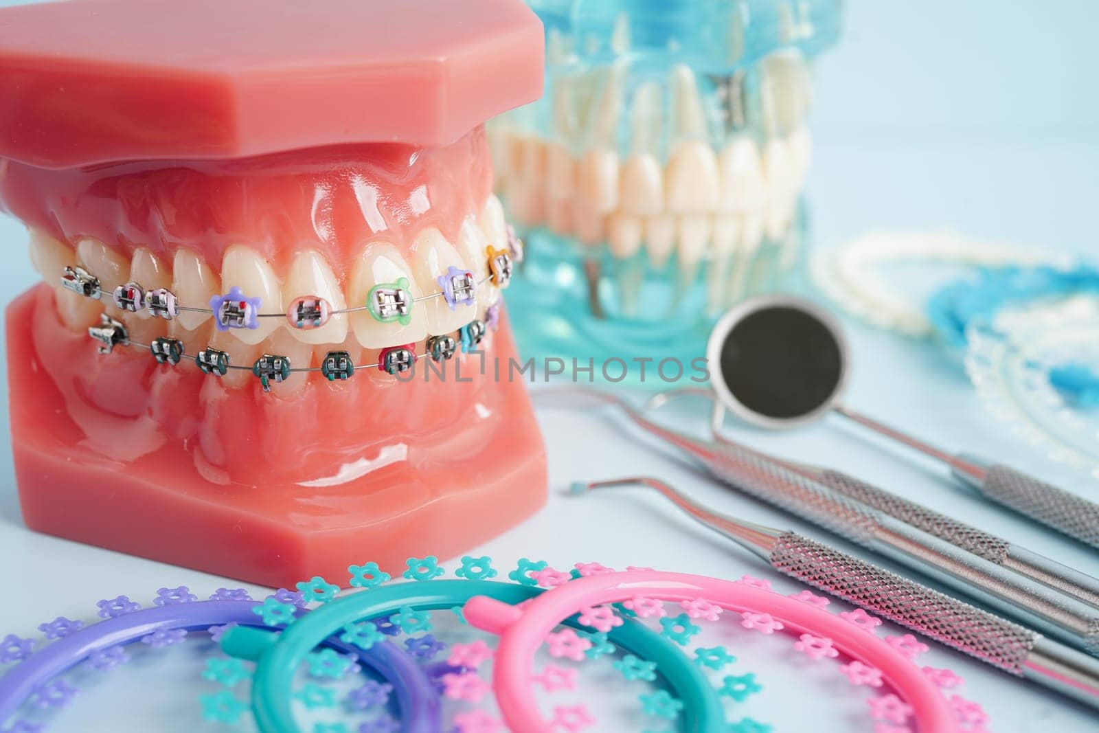 Orthodontic ligatures rings and ties, elastic rubber bands on orthodontic braces, model for dentist studying about dentistry.