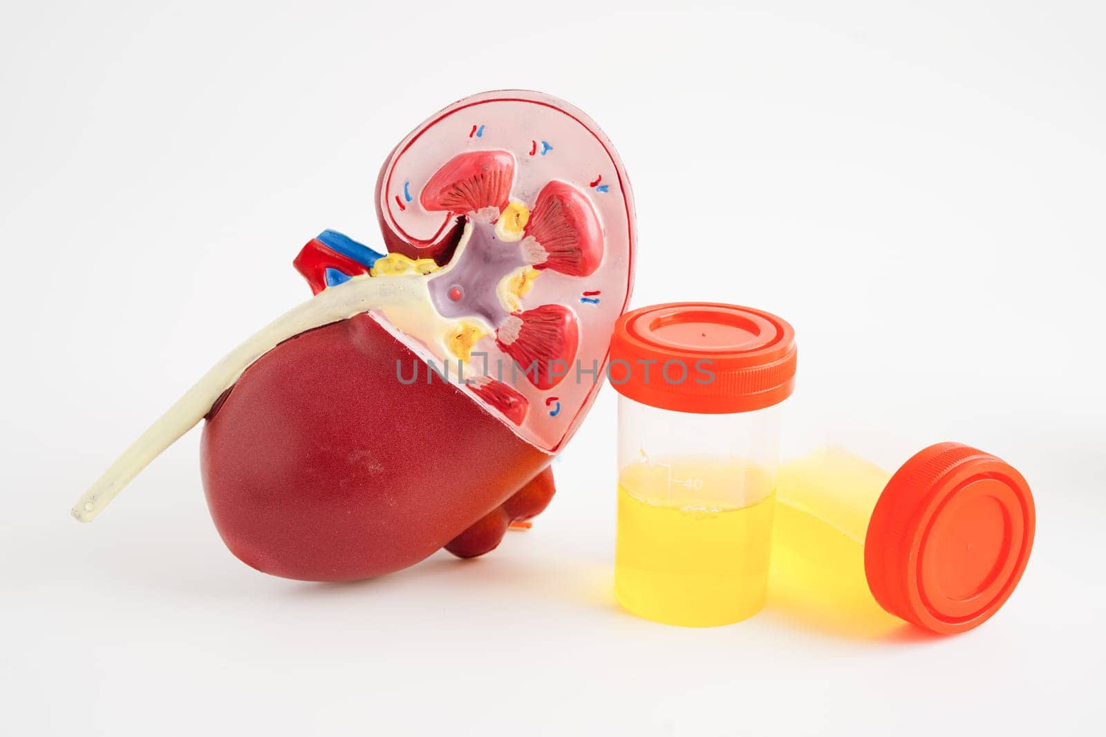 Urinalysis, Kidney and urine cup for check health examination in laboratory.