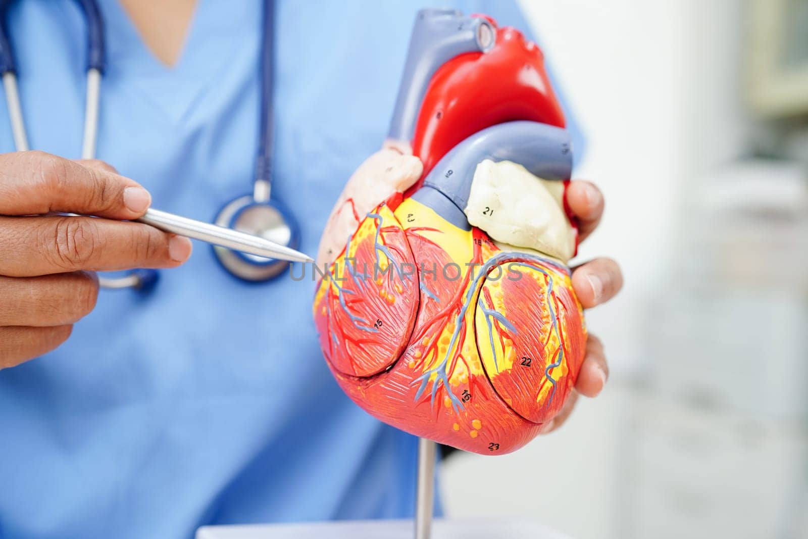 Cardiovascular disease CVD, doctor with heart human model anatomy for treatment patient in hospital.