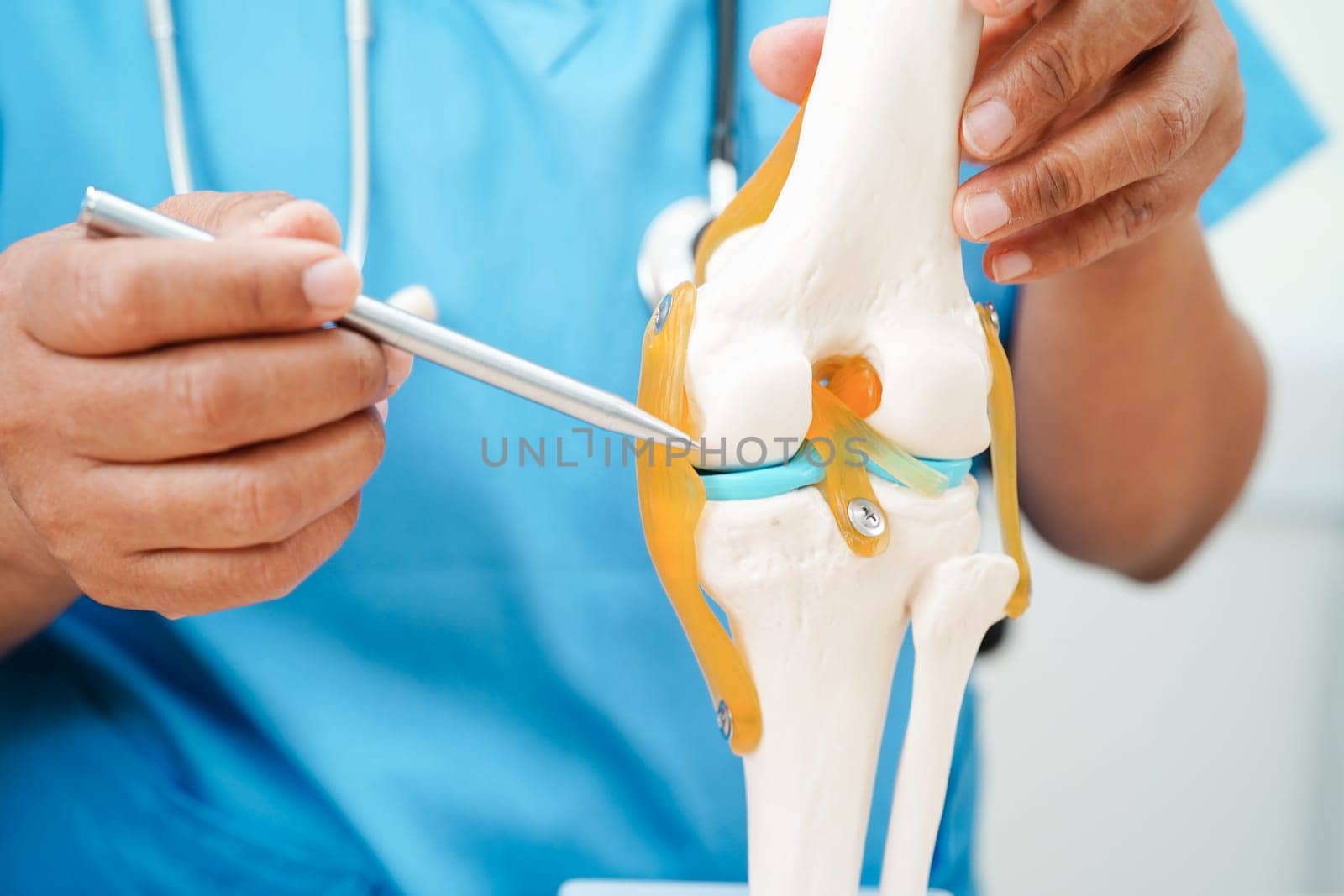 Knee osteoarthritis, Doctor showing model knee joint orthopedic.