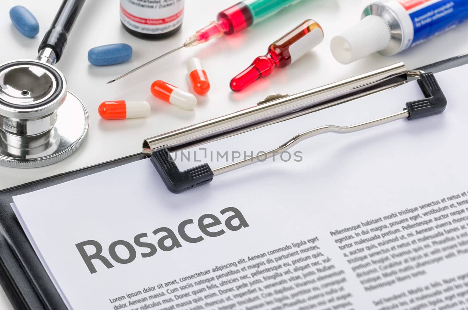 Rosacea written on a clipboard