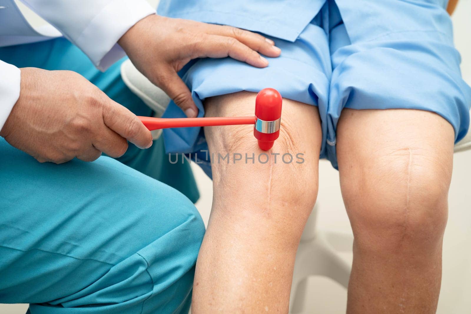 Asian doctor knock on knee reflex nerve for check and treatment senior patient in hospital.