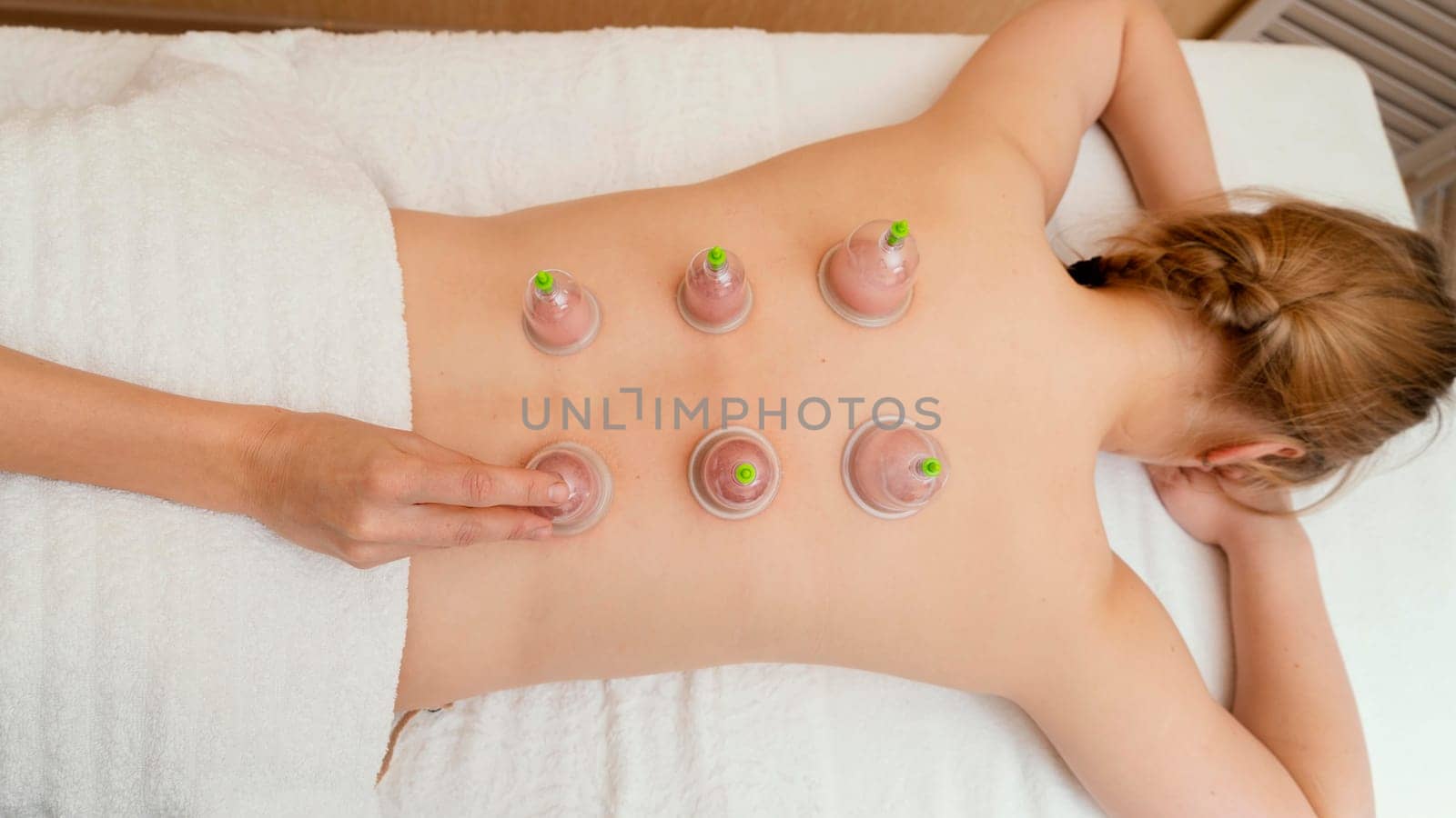 woman experiencing cupping therapy. High resolution photo
