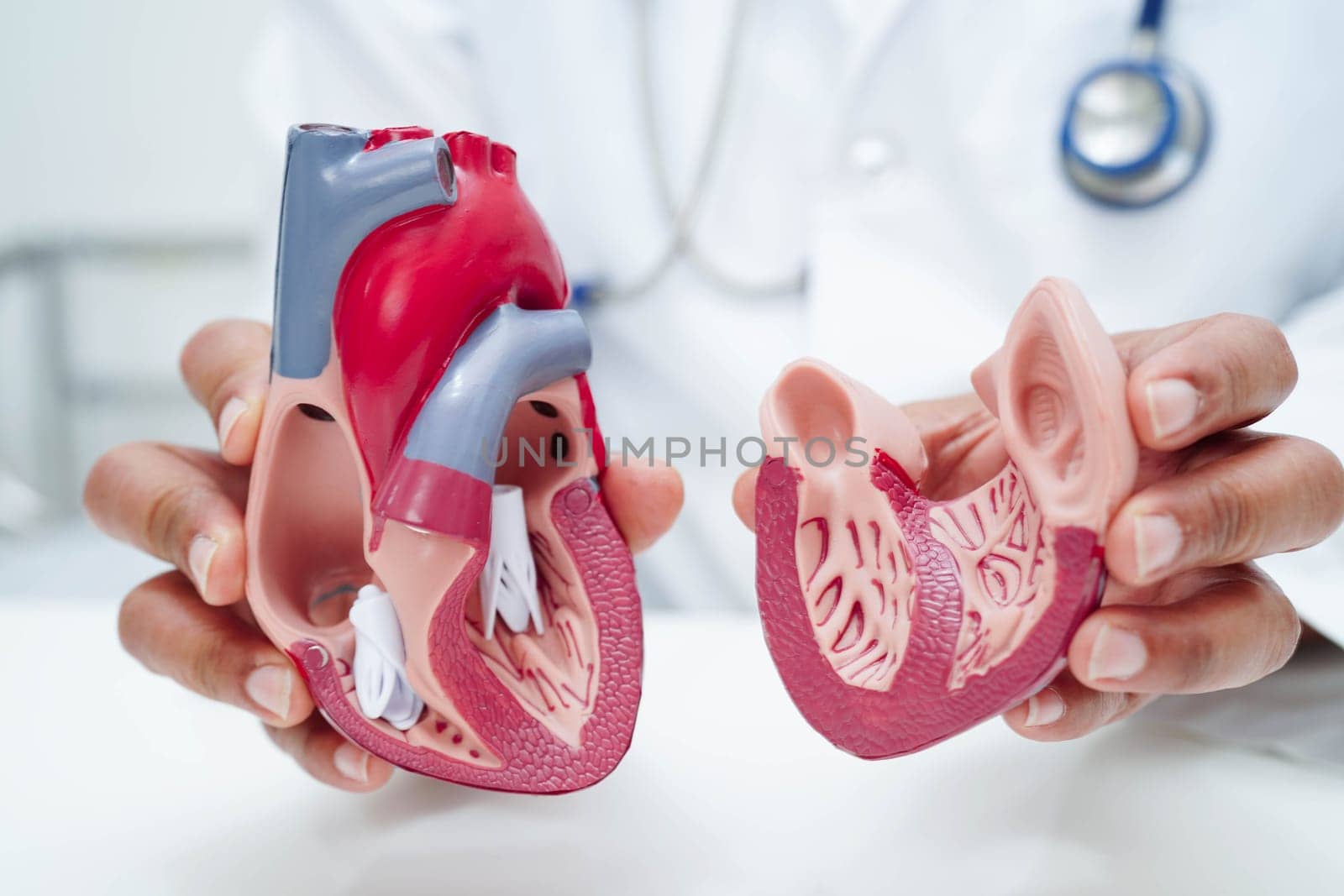 Cardiovascular disease CVD, doctor with heart human model anatomy for treatment patient in hospital.