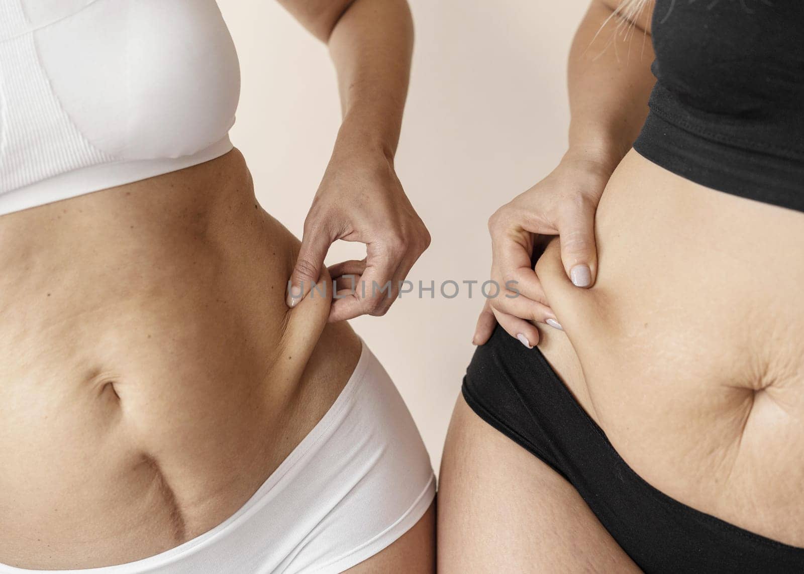 close up hands holding skin. High resolution photo