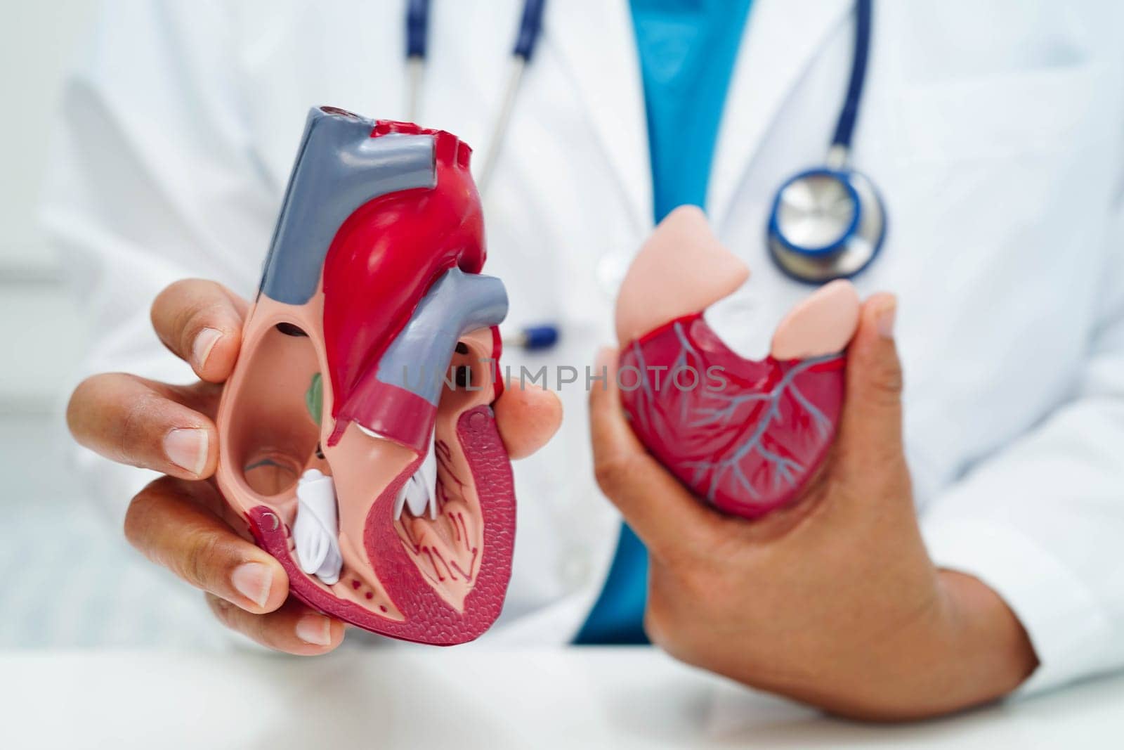 Cardiovascular disease CVD, doctor with heart human model anatomy for treatment patient in hospital.