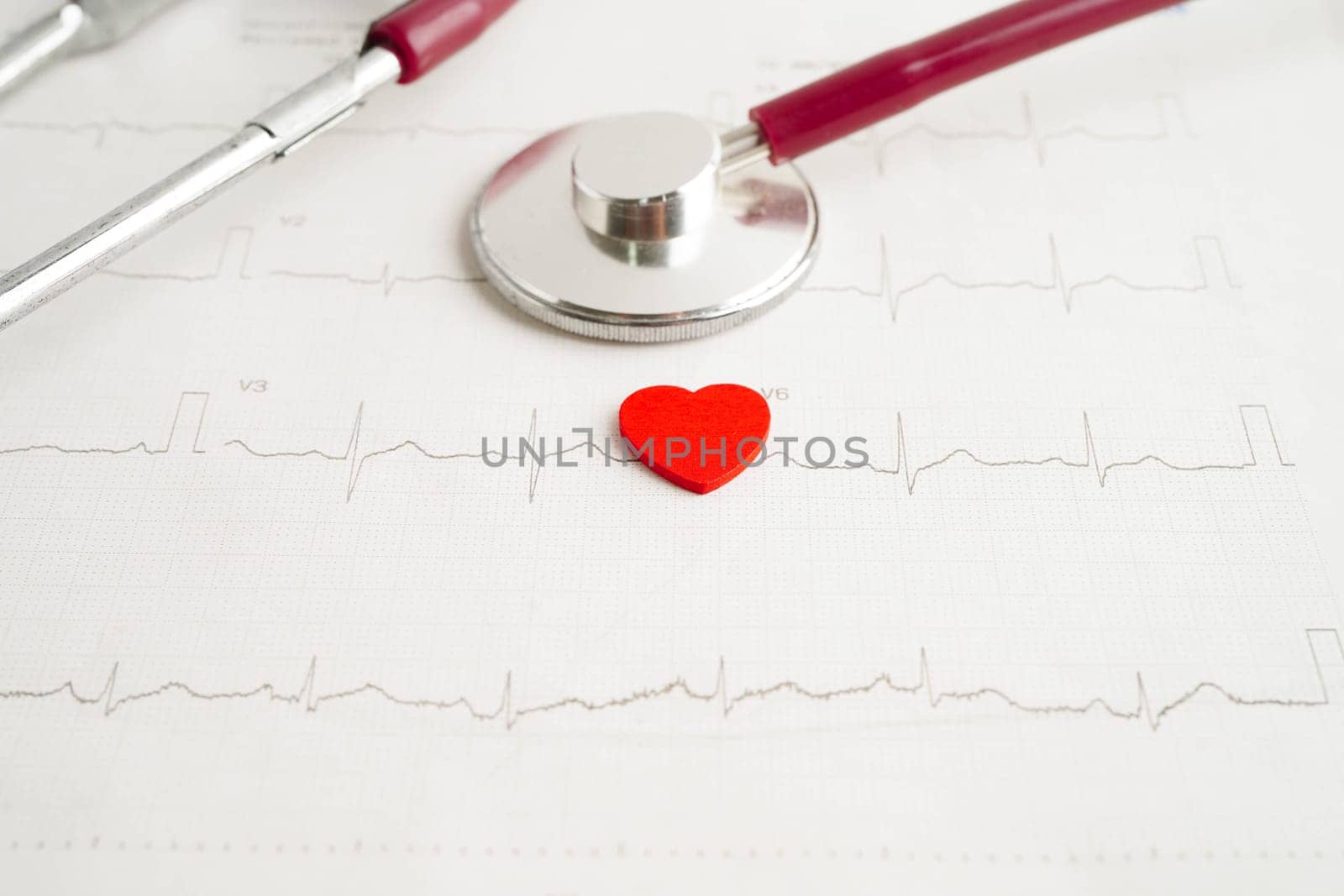 Stethoscope on electrocardiogram (ECG), heart wave, heart attack, cardiogram report.
