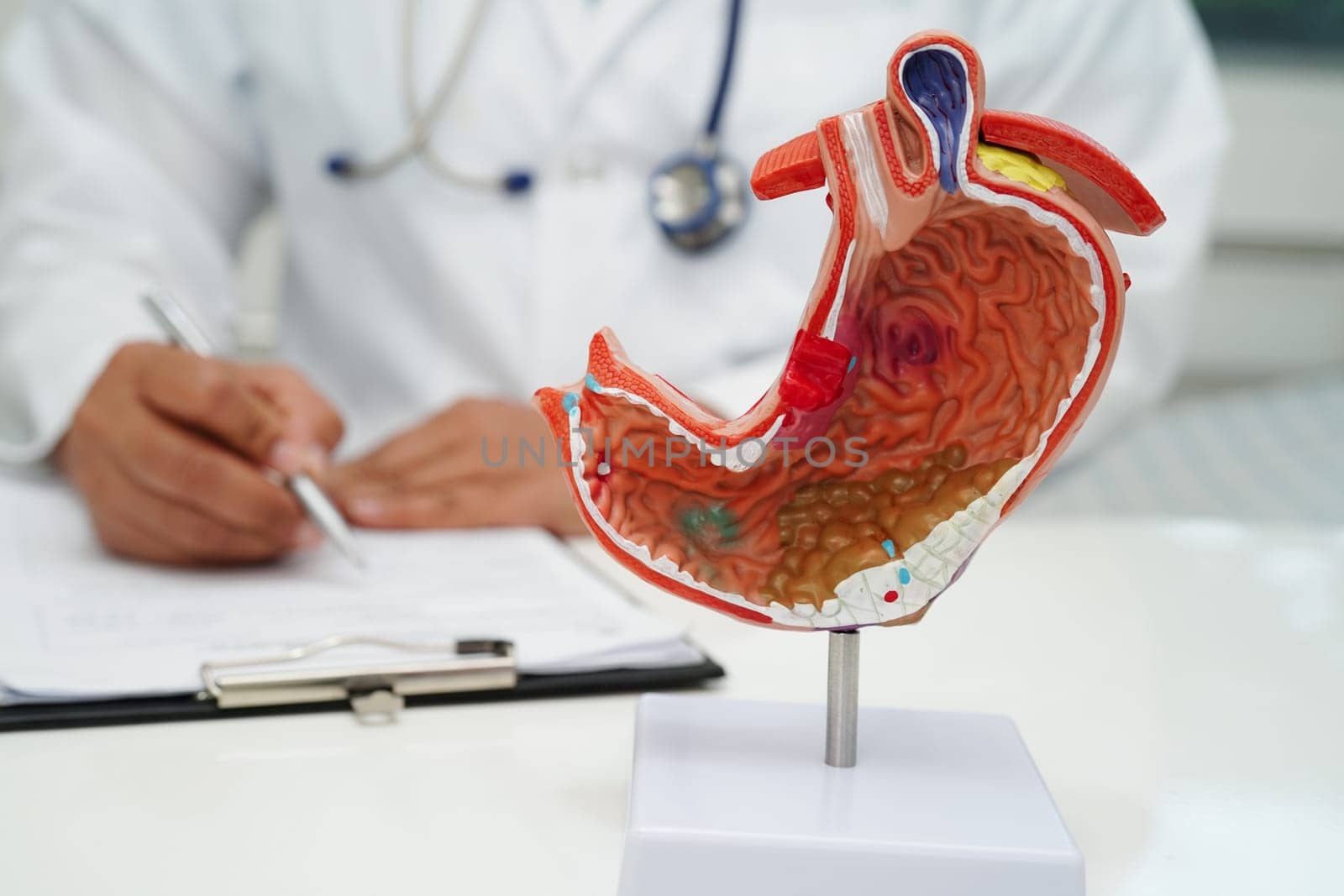 Stomach disease, doctor holding anatomy model for study diagnosis and treatment in hospital.