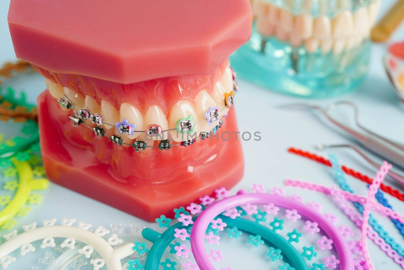 Orthodontic ligatures rings and ties, elastic rubber bands on orthodontic braces, model for dentist studying about dentistry.