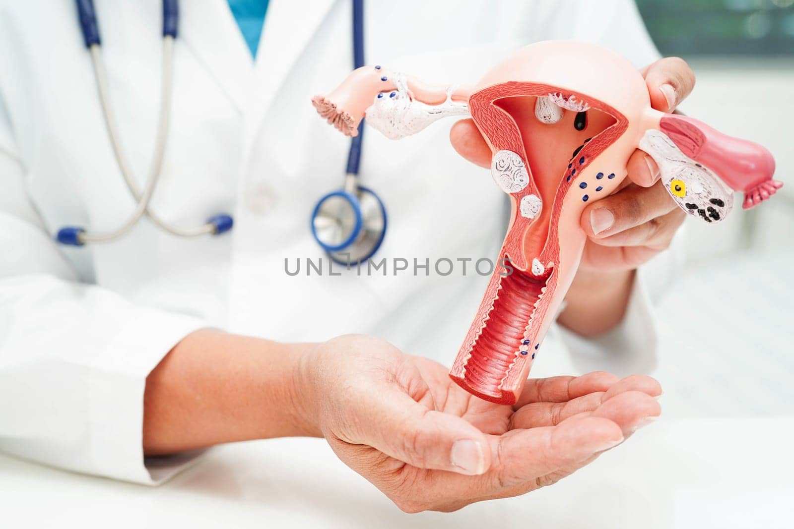 Uterus, doctor holding human anatomy model for study diagnosis and treatment in hospital.