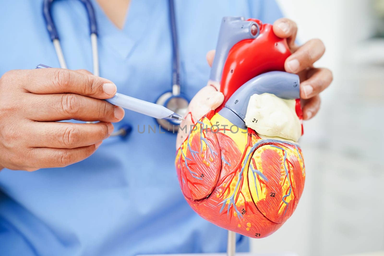 Cardiovascular disease CVD, doctor with heart human model anatomy for treatment patient in hospital.