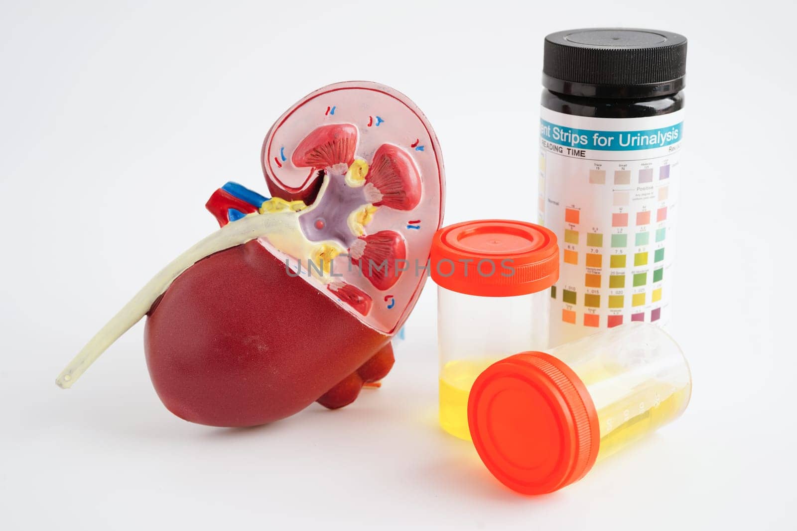 Urinalysis, Kidney and urine cup for check health examination in laboratory.