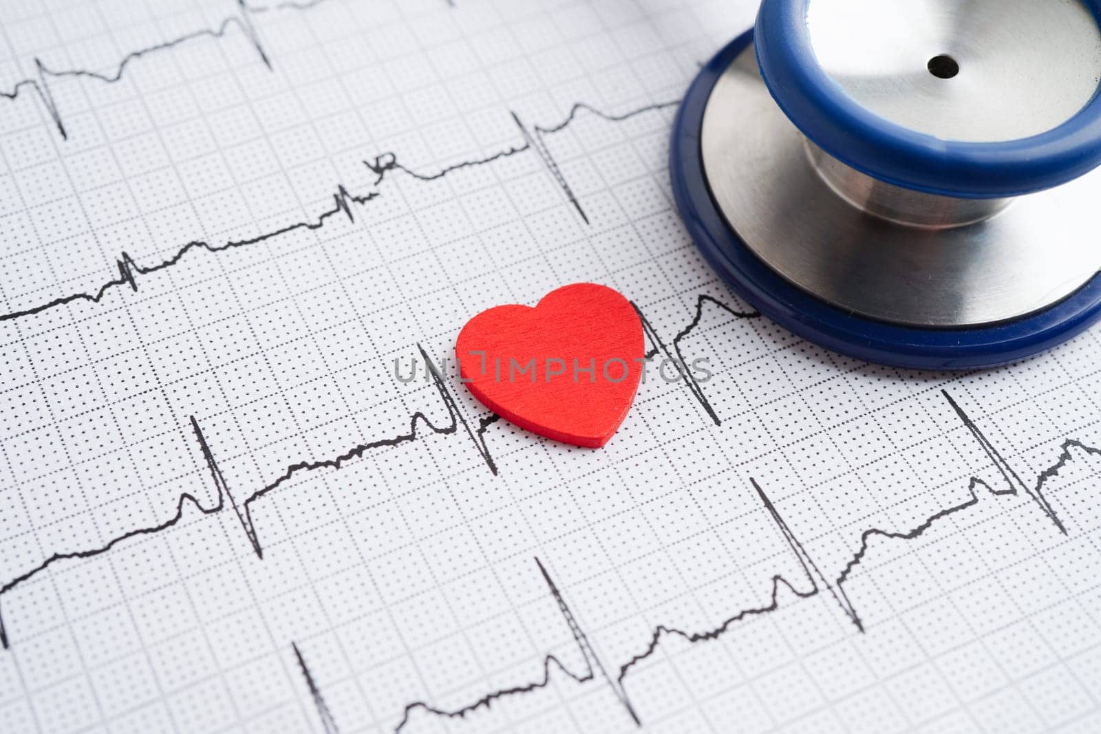 Stethoscope on electrocardiogram (ECG), heart wave, heart attack, cardiogram report.