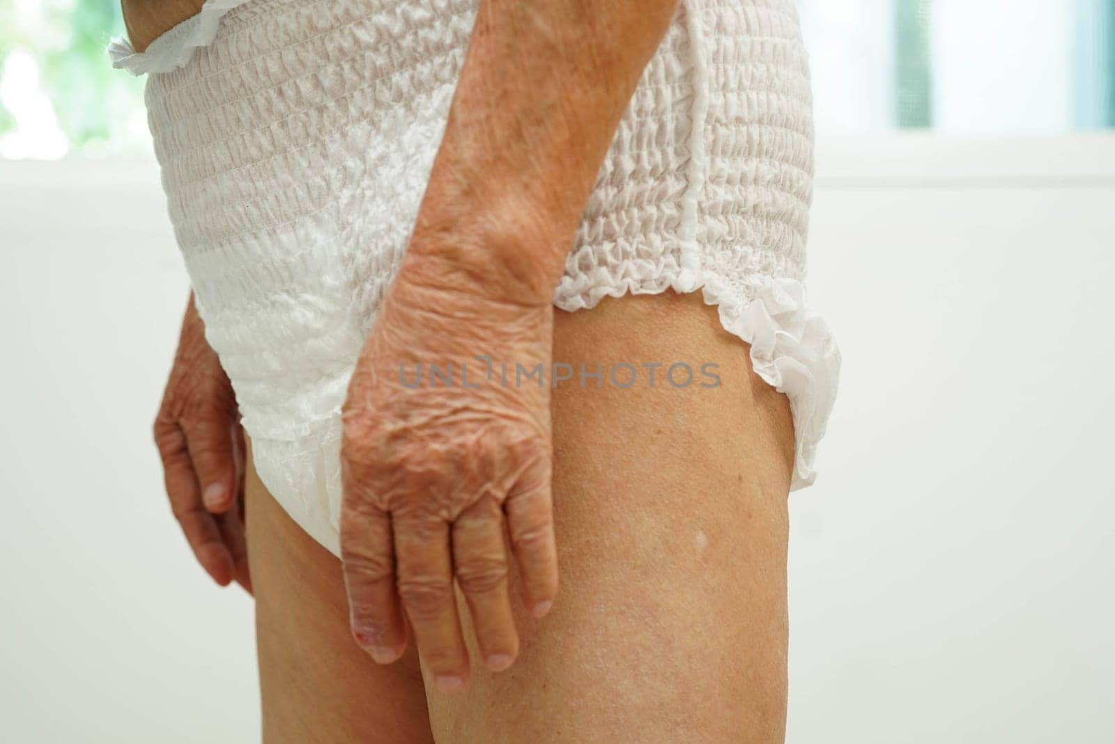 Asian senior woman patient wearing adult incontinence diaper pad in hospital.