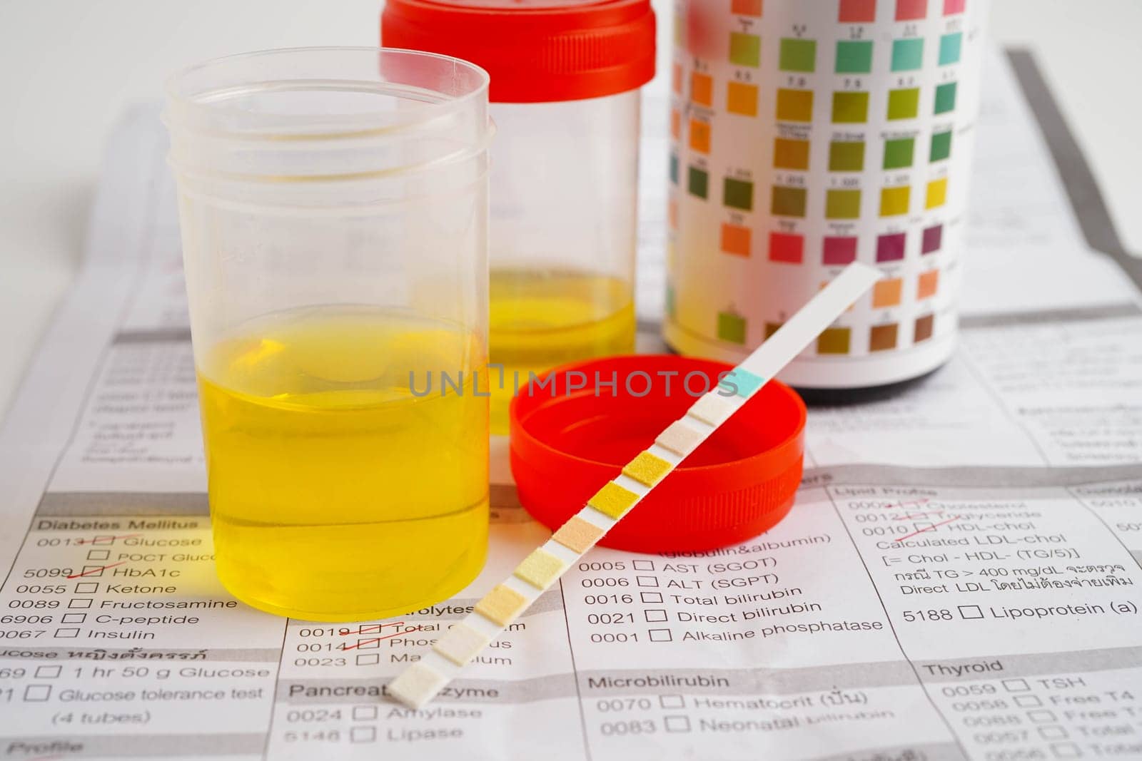 Urinalysis, urine cup with reagent strip pH paper test and comparison chart in laboratory.