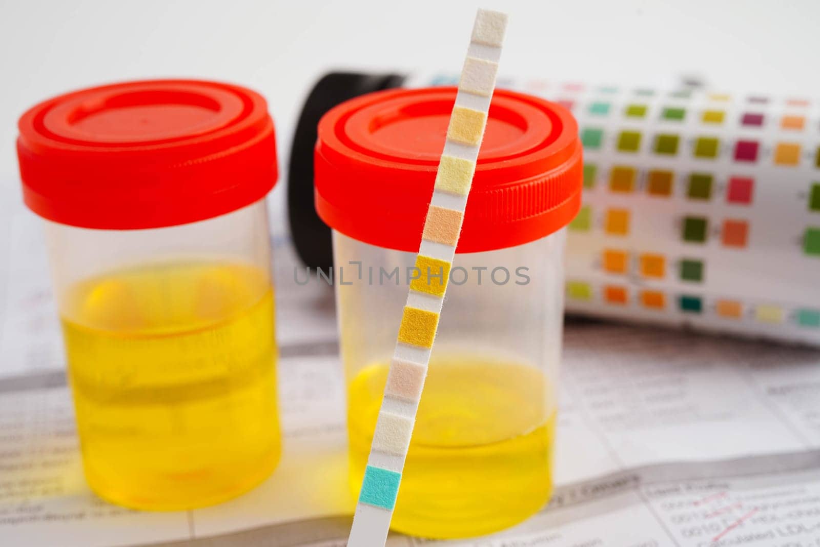 Urinalysis, urine cup with reagent strip pH paper test and comparison chart in laboratory.