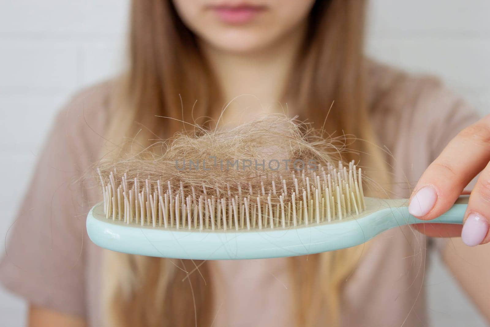 Woman's hair is falling out. hairbrush,hair loss.