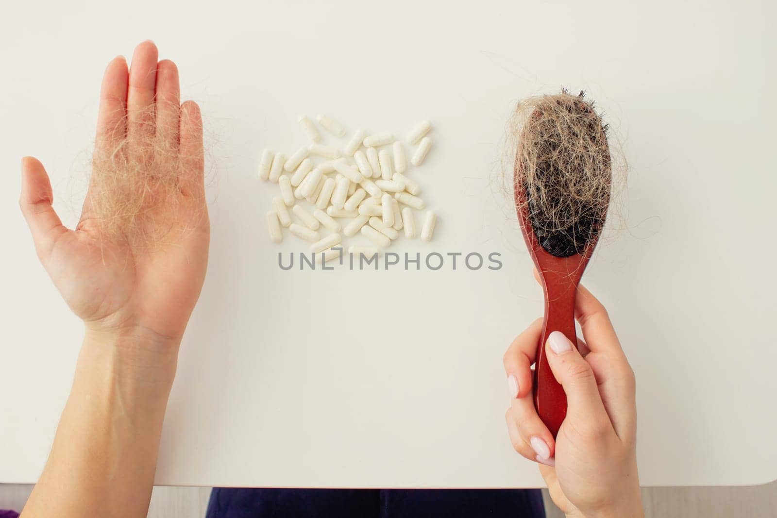 hair brush with hair and vitamins. hair loss.