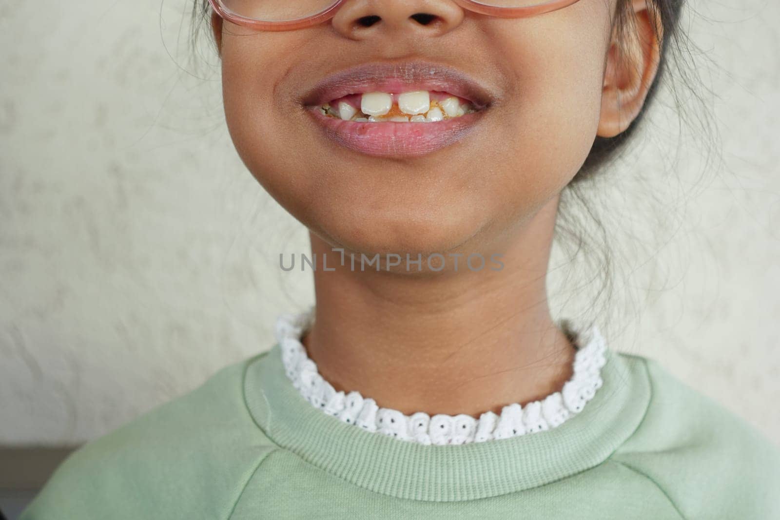 A cheerful girl displays her smile with missing teeth on a sunny day.
