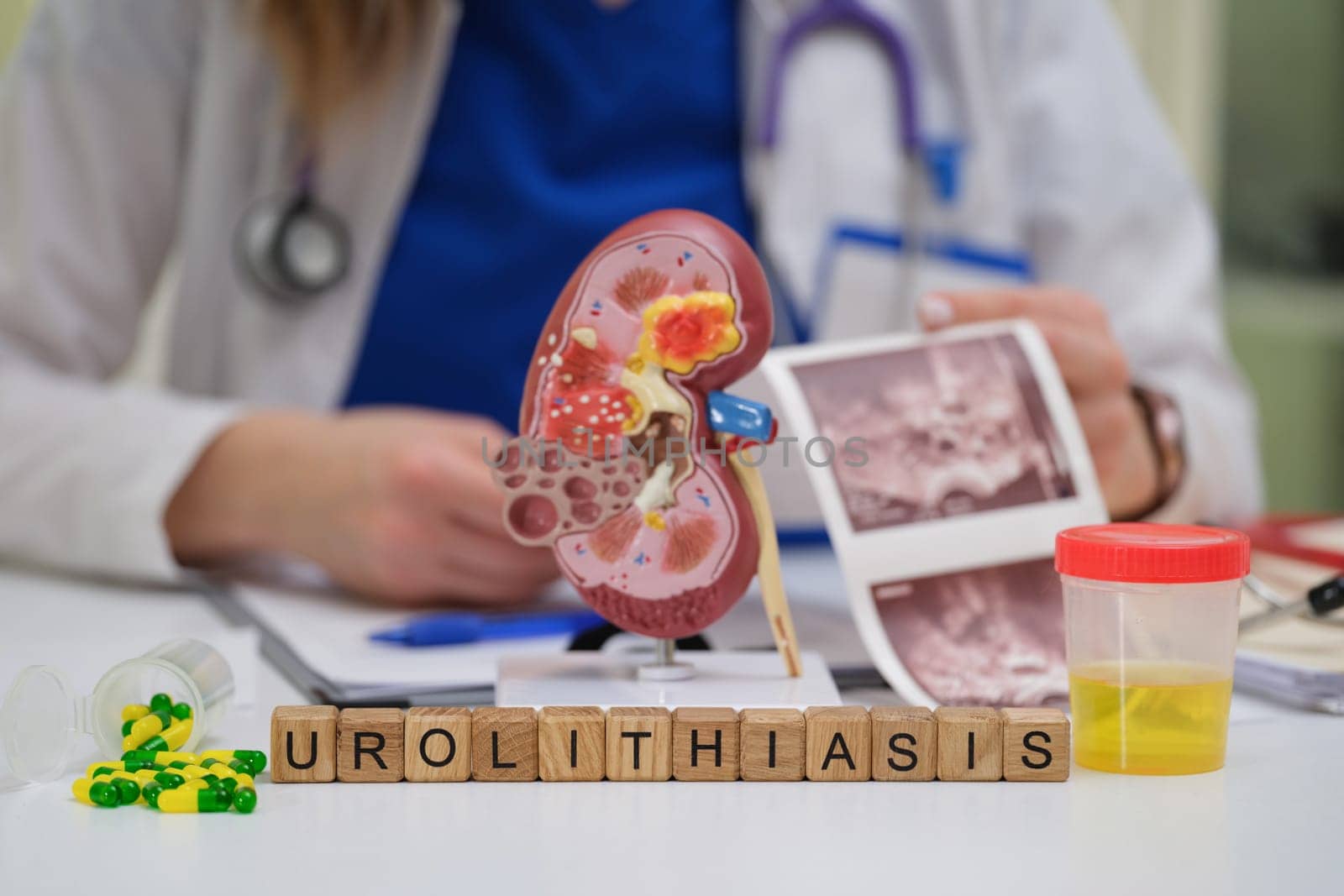 Explore causes and treatments of urolithiasis with visual aids and medical insights for deeper understanding