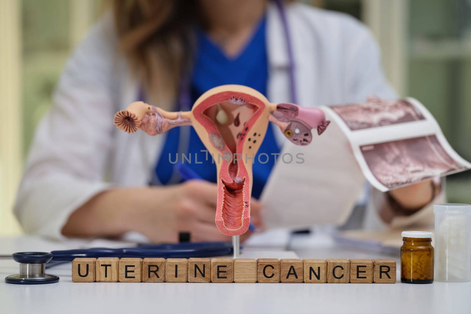 This is a comprehensive and detailed exploration of uterine cancer and its significant implications on womens health