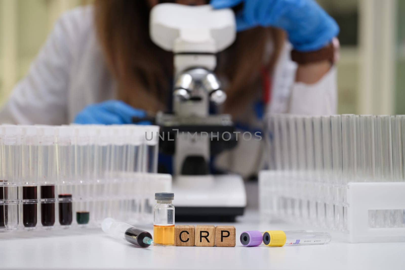 A skilled lab technician meticulously examines various samples for CRP analysis using a highpowered microscope