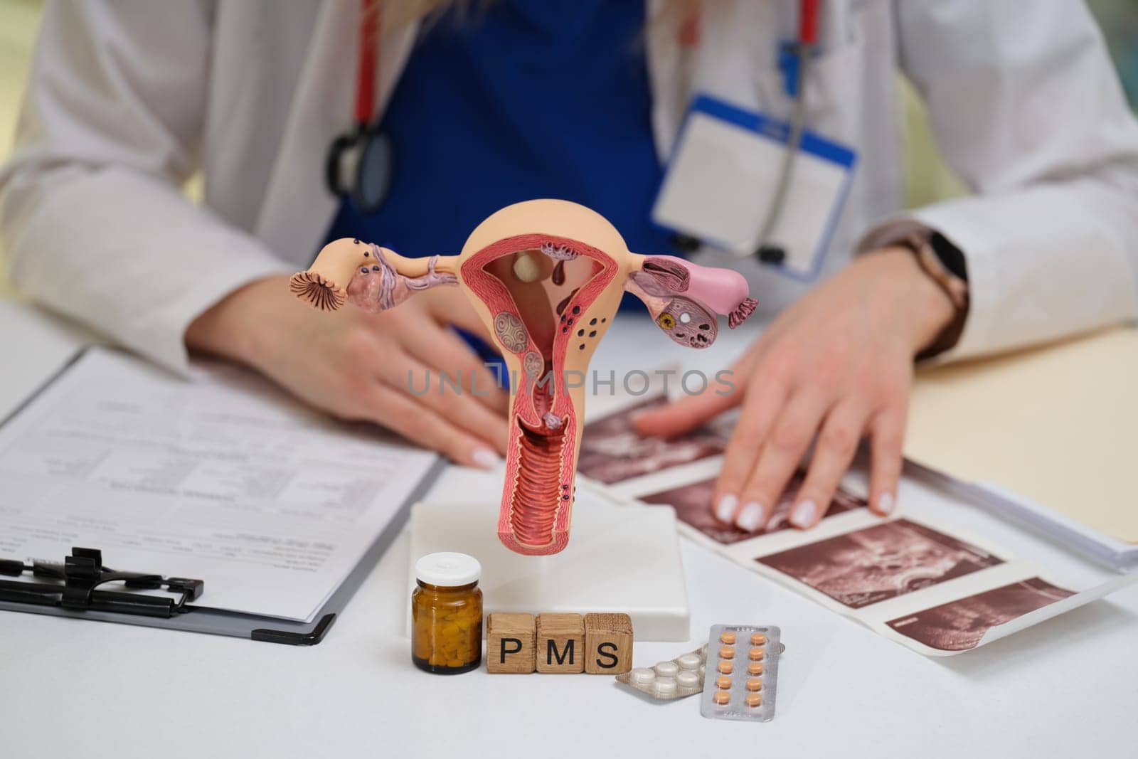 A healthcare professional is examining a detailed model of the female reproductive system along with PMS medications