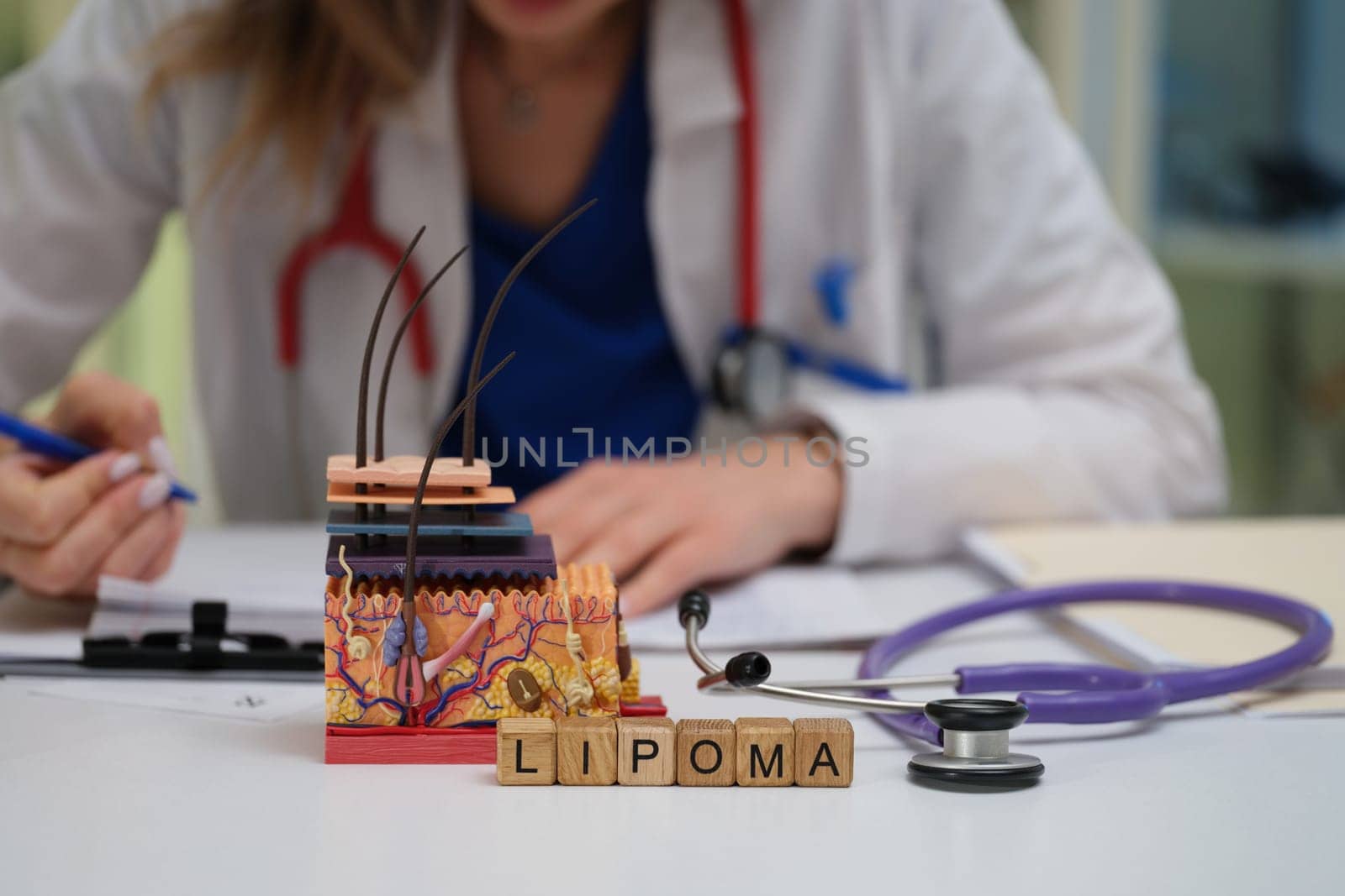 Discover and explore the intricate structure of lipoma through this highly informative model and research setting