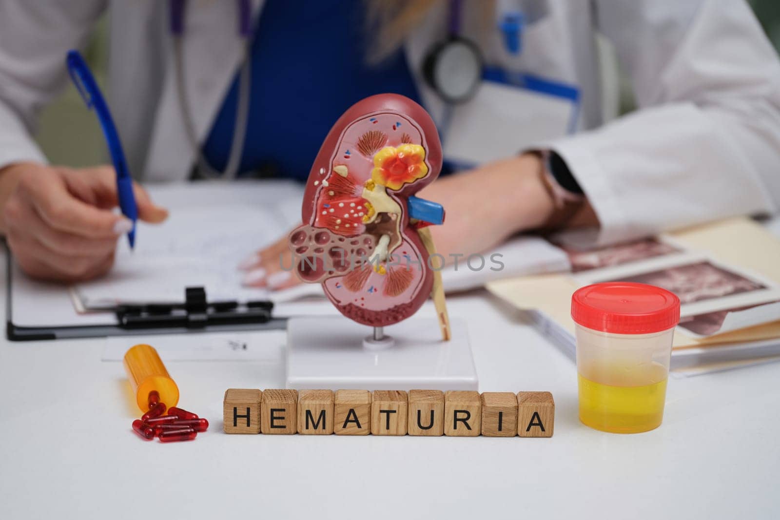A medical professional thoroughly examines the implications of hematuria, emphasizing the importance of kidney health