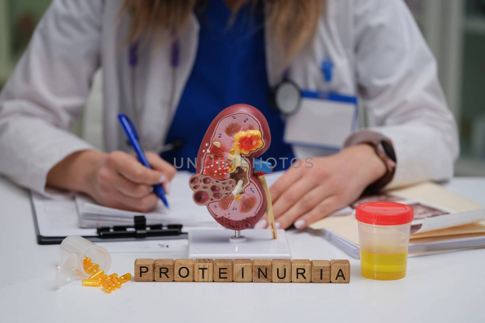 This visual representation illustrates proteinuria diagnosis, featuring a kidney model and urine sample for analysis