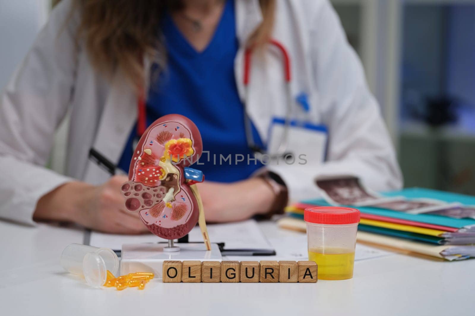 A healthcare professional reviews oliguria using a kidney model and urine analysis for better diagnosis