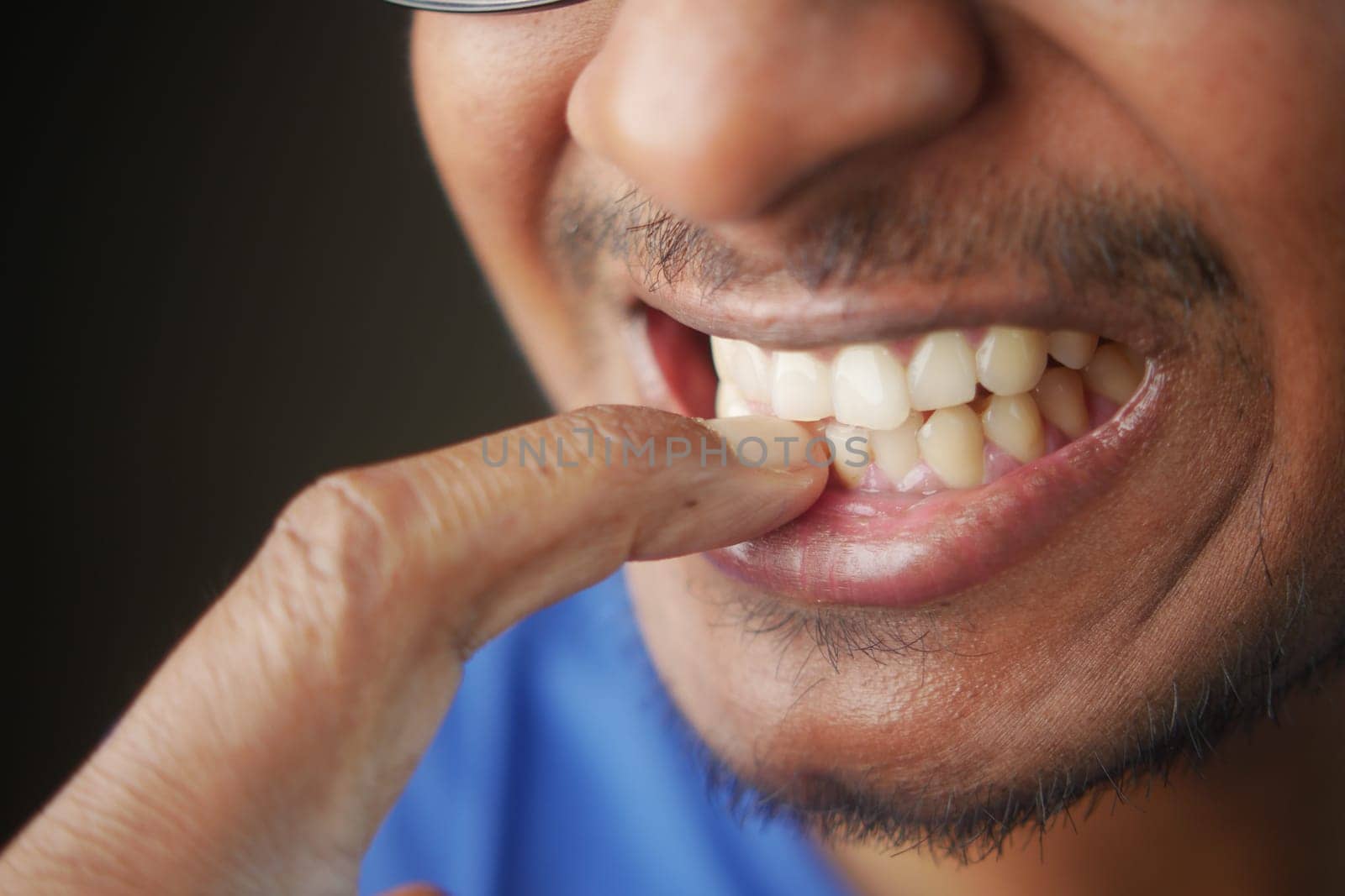 A person bites their fingernails and displays a wide smile indoors.