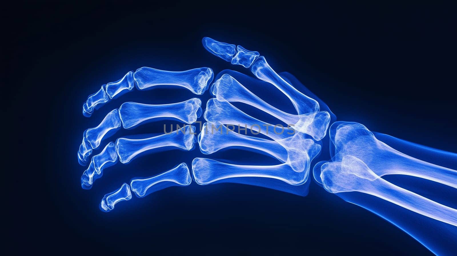 Close-up x-ray image of a human hand with bones highlighting wrist inflammation or injury